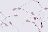 Spermatozoïdes de Taureau x320